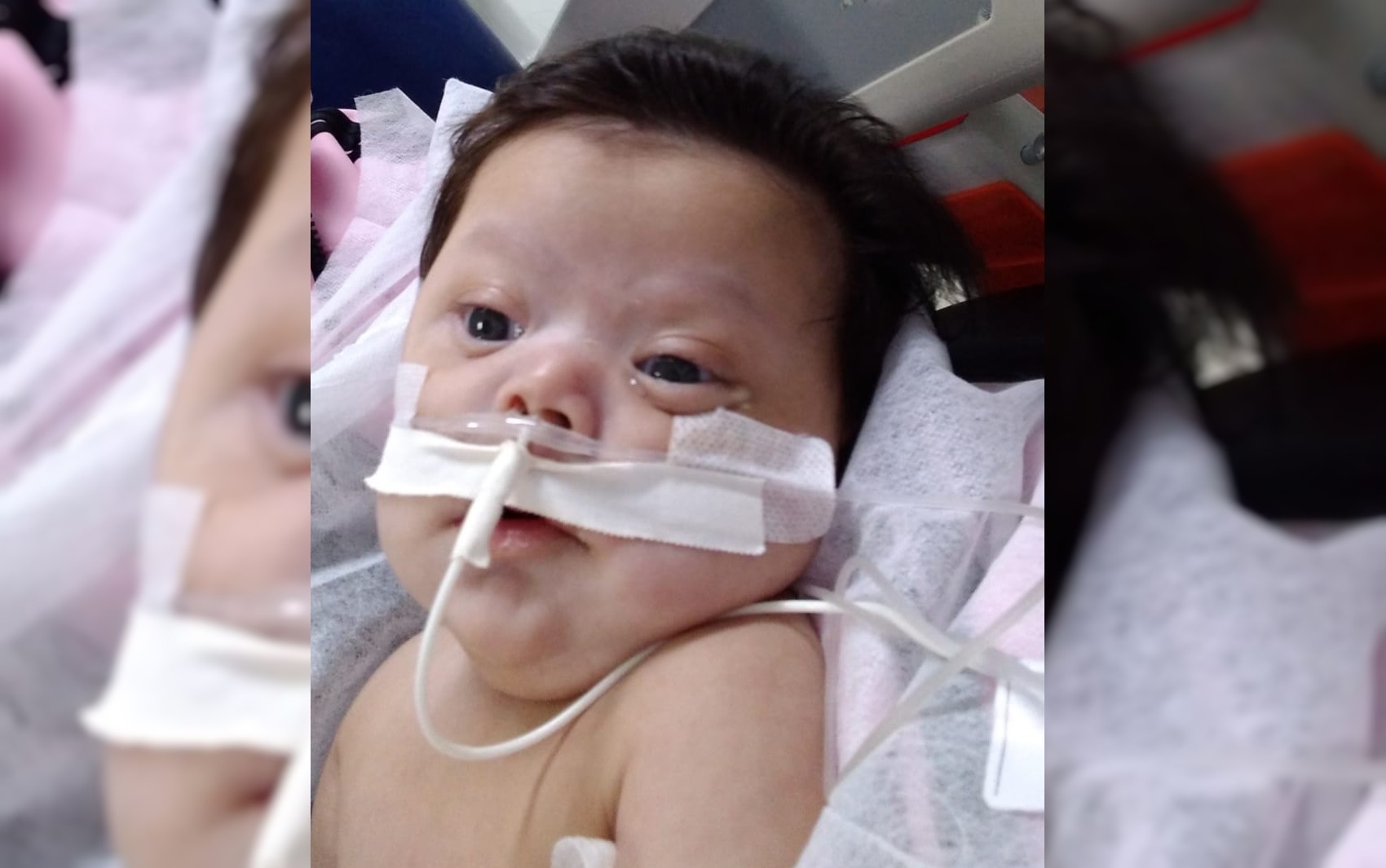 Bebê com Down e problema cardíaco precisa de transferência de hospital para fazer exame e evitar intubação, em Goiânia