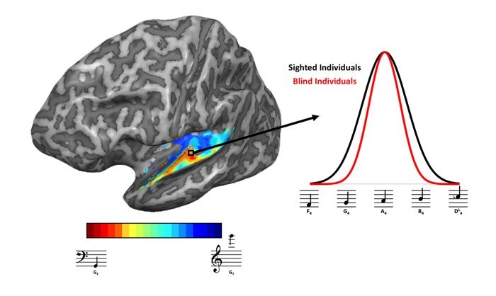 Esquerda: As cores quentes representam regiões do cérebro que mostraram a maior resposta a tons graves, enquanto as cores azuis representam regiões que respondem mais a tons agudos. (Foto: Kelly Chang/Universidade de Washington)