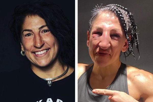 A boxeadora Miriam Gutierrez ficou com o rosto completamente inchado após lutar contra Amanda Serrano neste final de semana (Foto: Reprodução / Instagram)