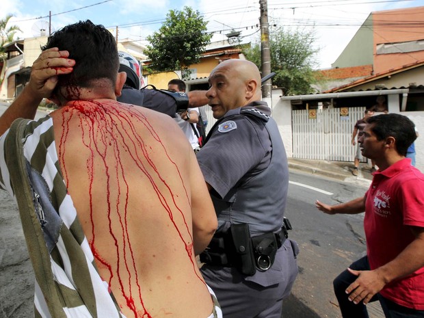 Homem foi ferido em ação da polícia para dispersar confusão de manifestantes em frente ao prédio onde vive ex-presidente Lula em São Bernardo do Campo (SP) (Foto: Paulo Whitaker/Reuters)