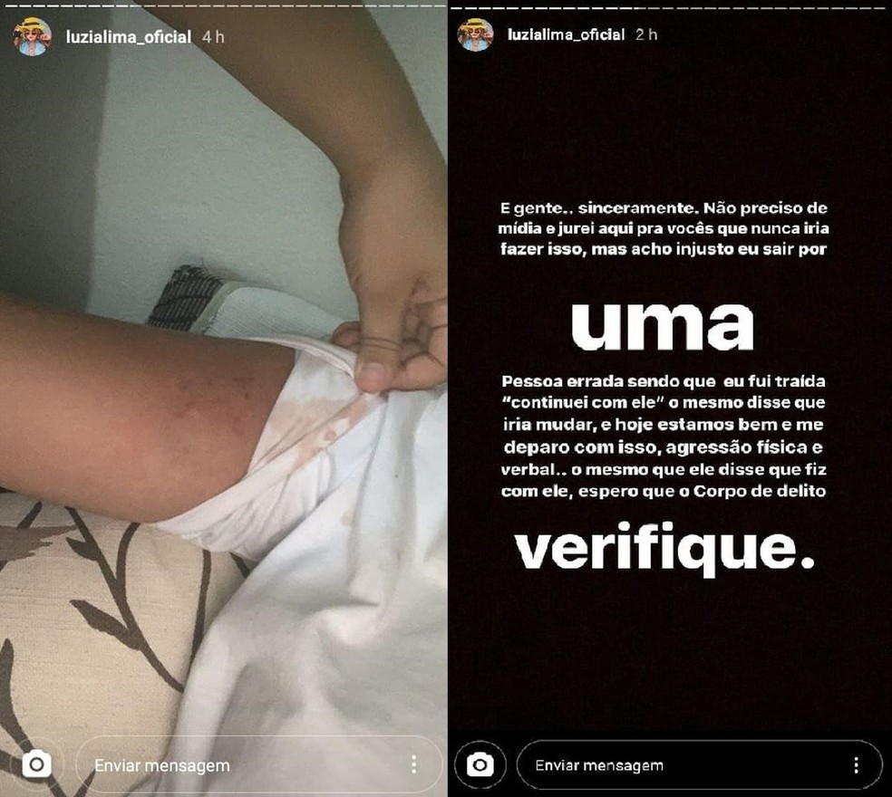 Ex-namorada de Devinho Novais usou rede social para denunciar cantor de agressão — Foto: Reprodução/Instagram/Arquivo