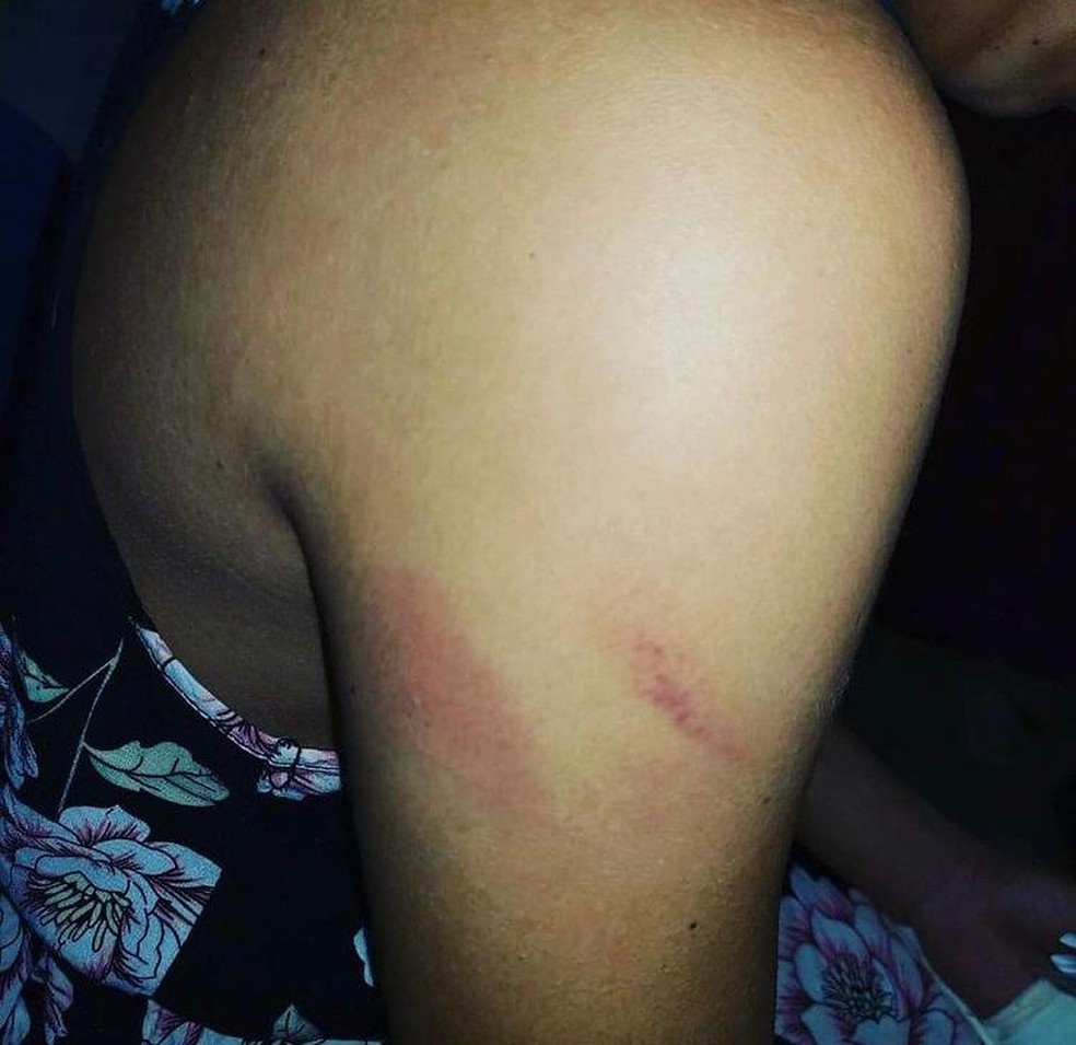 Uma jovem de 19 anos foi vítima de tentativa de feminicídio em Extrema (RO) — Foto: Polícia Civil/Divulgação
