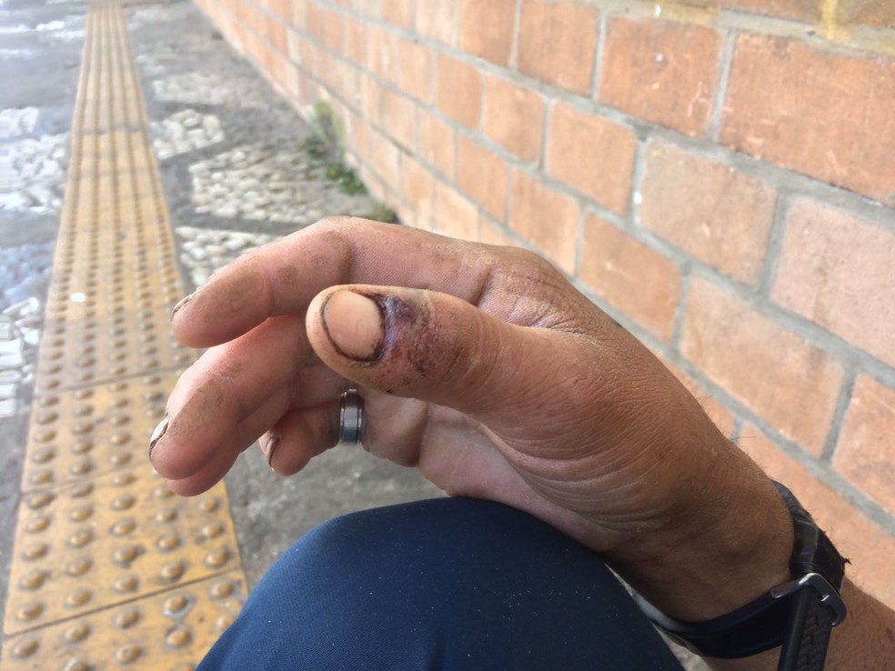 No dia seguinte à morte de carroceiro, Gilvan estava com os dedos machucados (Foto: Paula Paiva Paulo/G1)