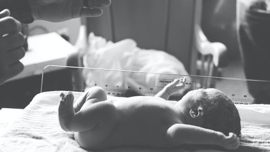 Minuto de ouro: saiba como os médicos agem para salvar a vida do bebê, caso ele não respire bem ao nascer