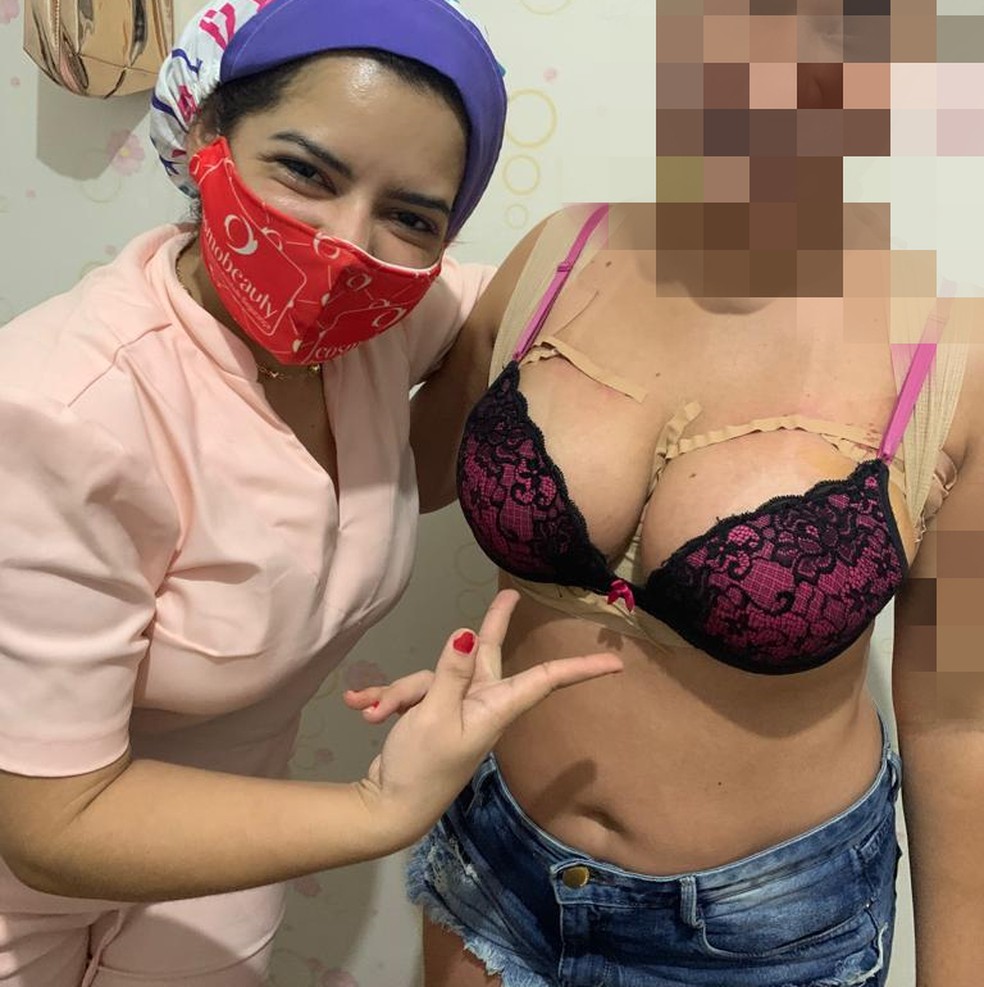 Mulher realizava procedimentos estéticos clandestinos em Manaus. — Foto: Reprodução