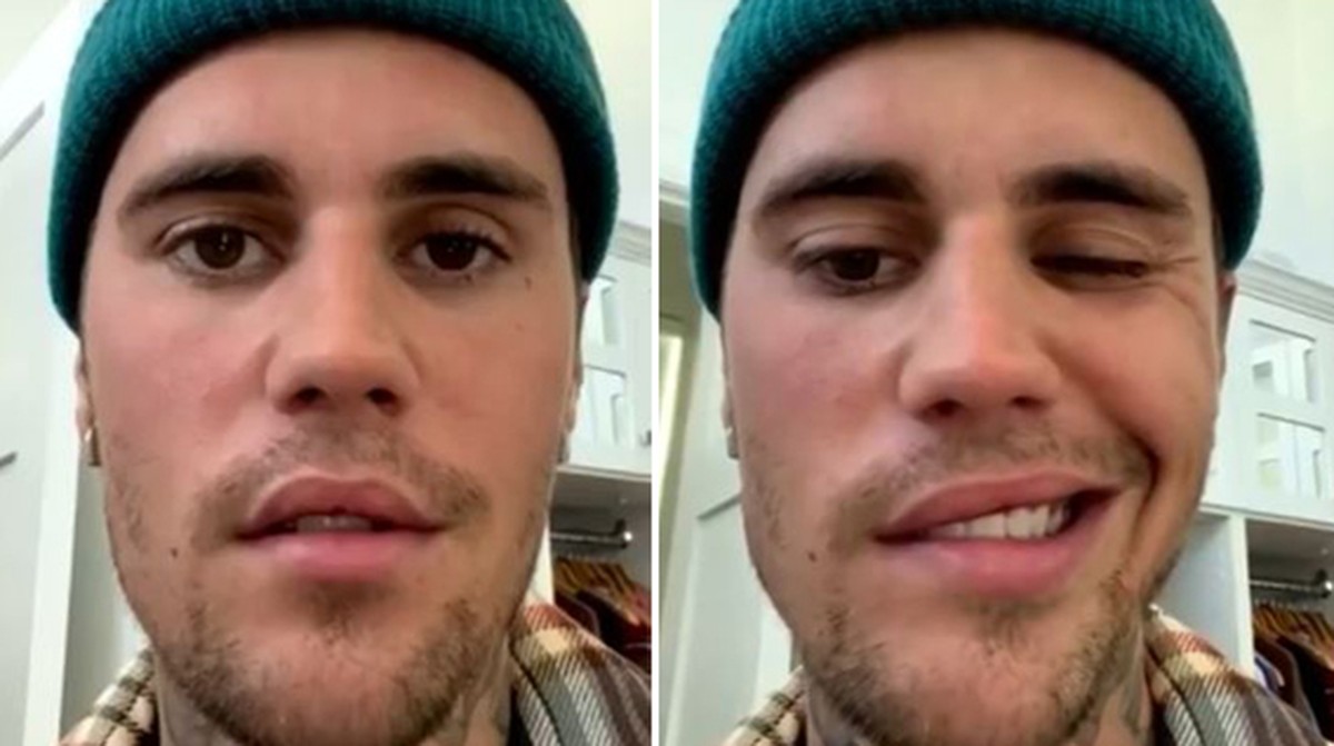Justin Bieber mostra ‘primeiros sinais’ de recuperação da síndrome de Ramsay Hunt, diz médico |  Música