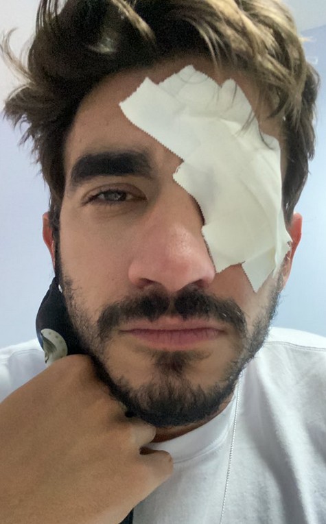 Gui Napolitano machuca olho e mostra curativo (Foto: Reprodução/Instagram)