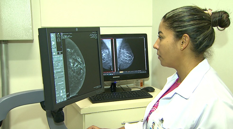 Radiologista analisa mamografia no Hospital de Amor de Barretos (SP) — Foto: EPTV/Reprodução
