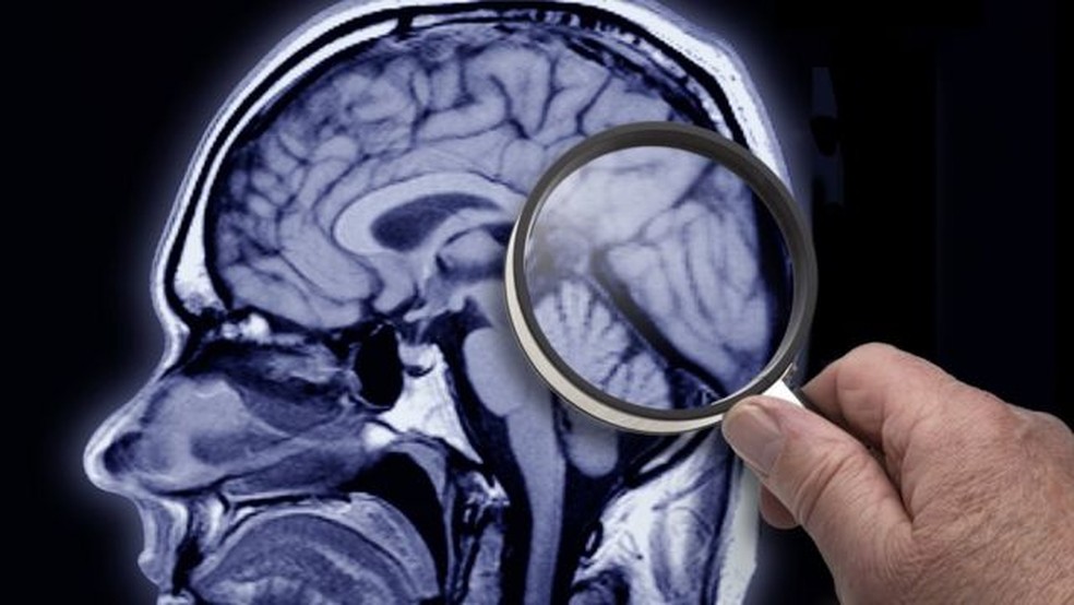 O cérebro humano atual é menor que o dos nossos ancestrais — Foto: Getty Images via BBC
