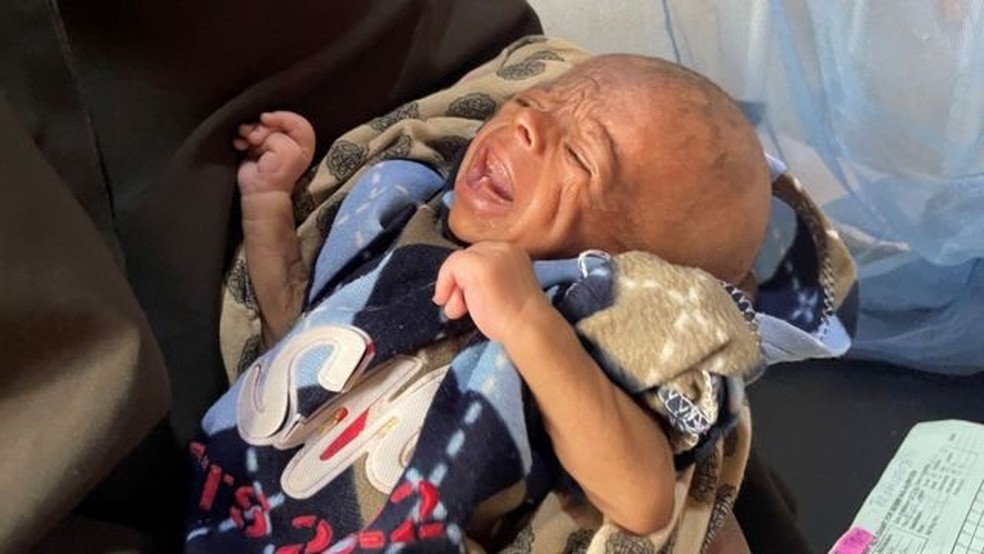 Mohamed, de 30 meses, acaba de chegar a Baidoa e está em estado crítico, assim como sua mãe — Foto: BBC/Ed Habershon