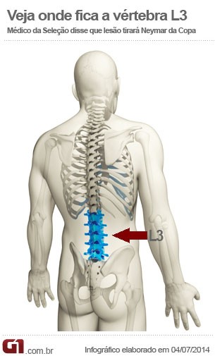 Info Neymar vértebra L3 (Foto: Editoria de Arte/G1)