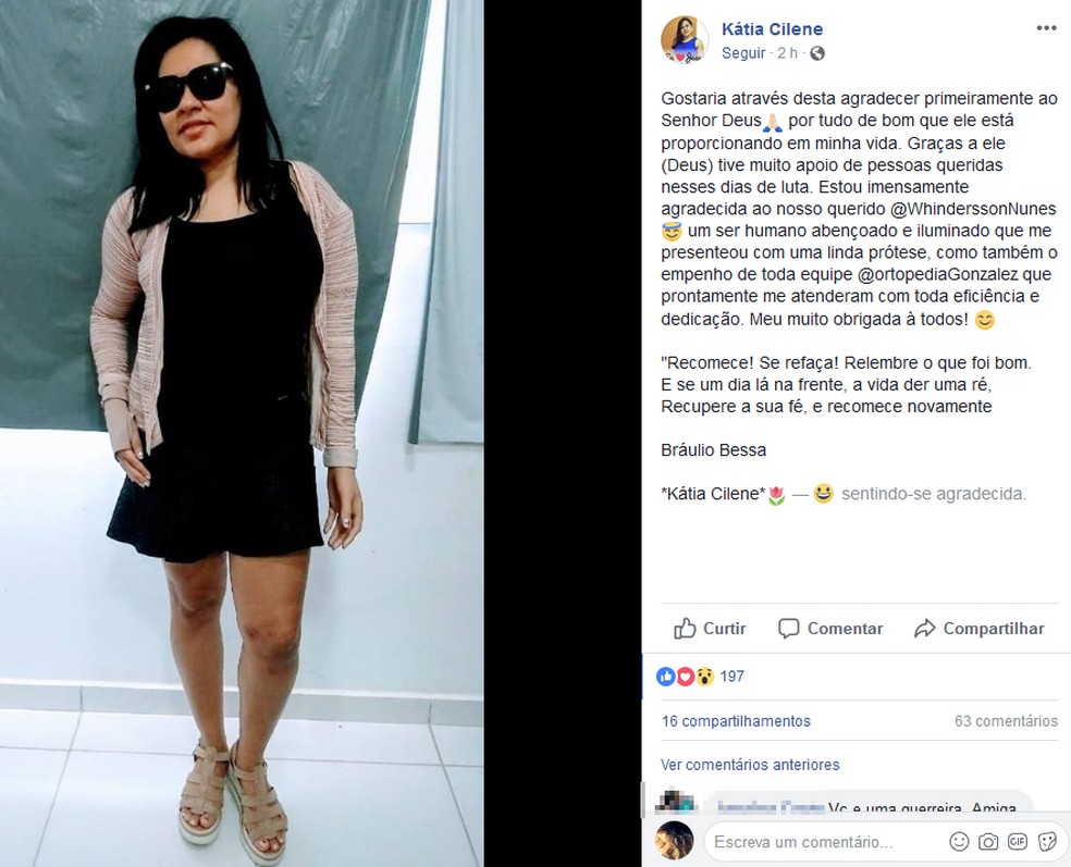 KÃ¡tia Cilene agradeceu youtuber pela prÃ³tese em postagem na rede social (Foto: ReproduÃ§Ã£o/Facebook)