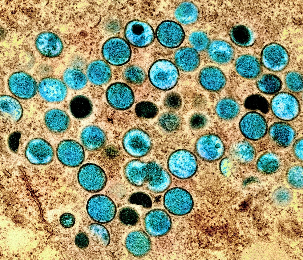 Imagem de microscópio colorizada artificialmente mostra vírus da varíola dos macacos (azul) — Foto: NIAID-NIH