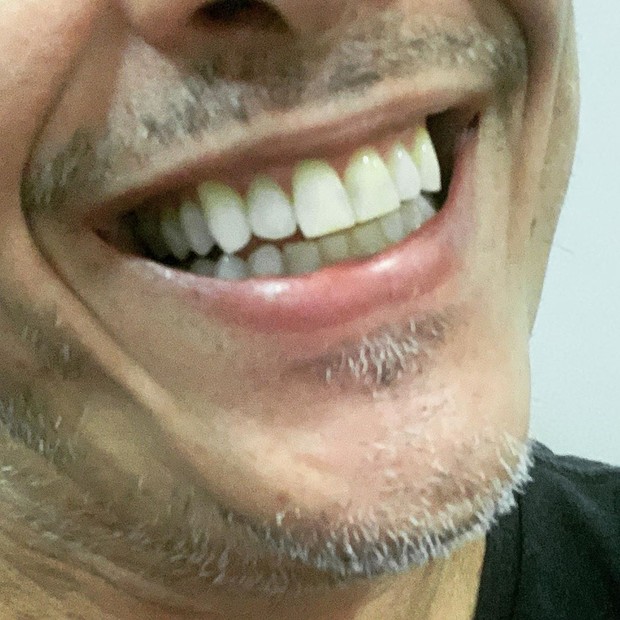 Guilherme Fontes mostra seu sorriso natural (Foto: Reprodução/Instagram)