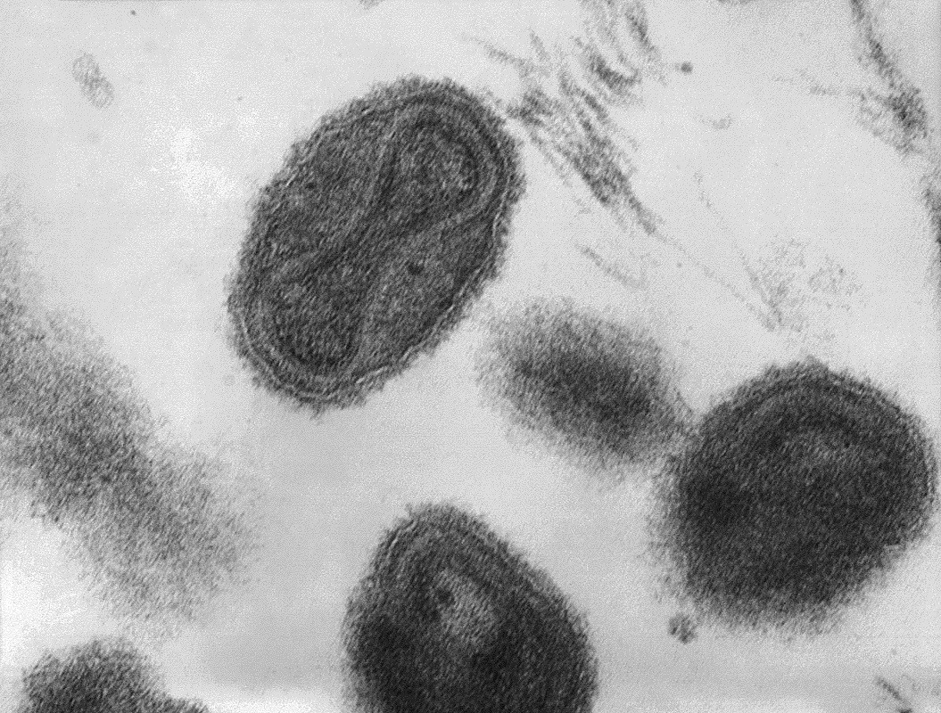 Vírus de varíola vistos com um microscópio. Microrganismo matou 300 milhões de pessoas só no século 20 (Foto: Wikimedia Commons)