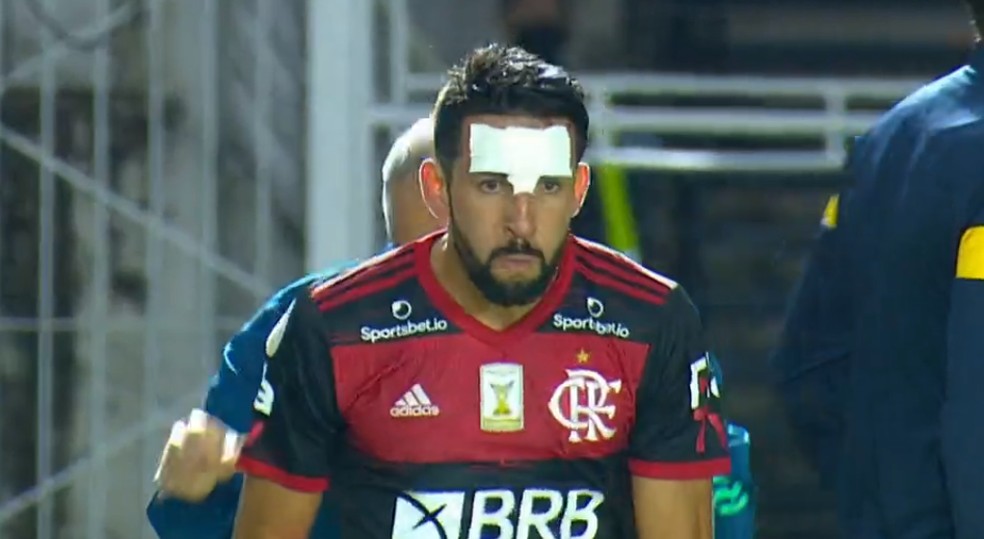 Isla, do Flamengo, com curativo após sofrer pisada na testa — Foto: Reprodução