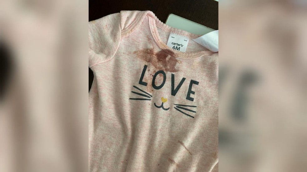 Roupa de criança ensanguentada após cair em creche, em Taguatinga, no DF  — Foto: Arquivo pessoal 
