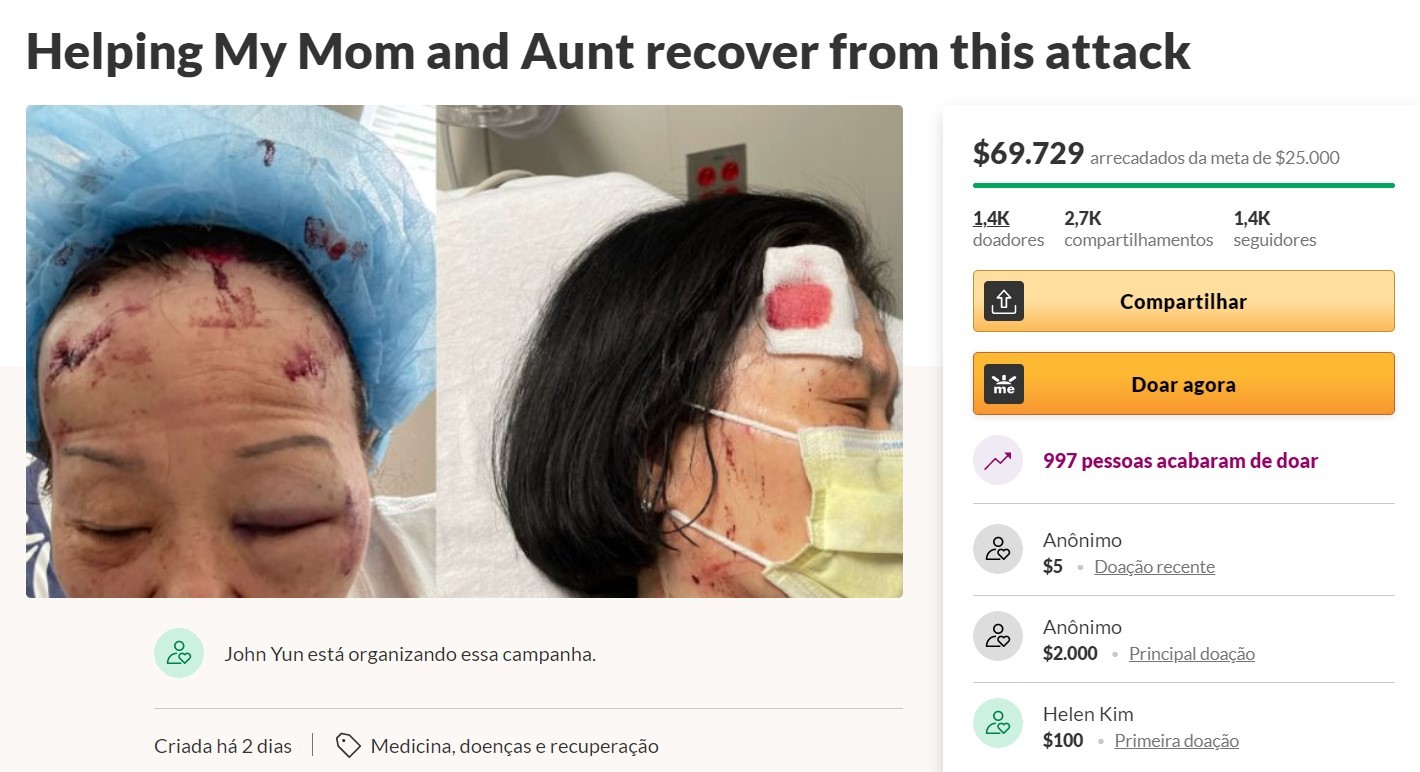 Nos EUA, duas mulheres asiáticas são atacadas com pedaço de concreto (Foto: Reprodução)