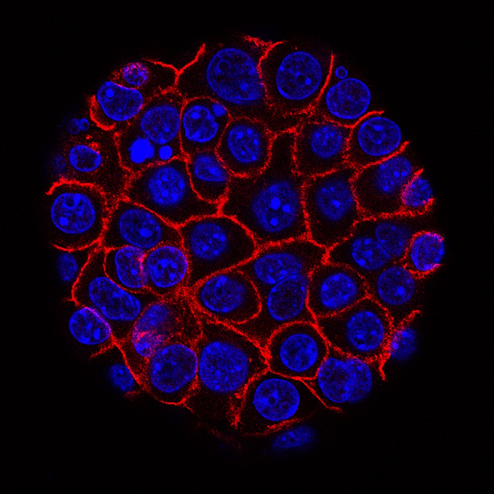 Cientistas desenvolvem exame de sangue capaz de detectar câncer precocemente