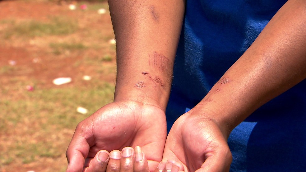 Edilson ficou ferido ao entrar no terreno para tentar salvar o menino — Foto: Reprodução/TV Globo