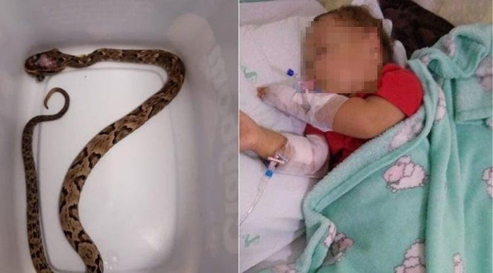 Criança de 1 ano é picada por cobra enquanto brincava; ela foi encaminhada para o hospital — Foto: Reprodução/ NSC