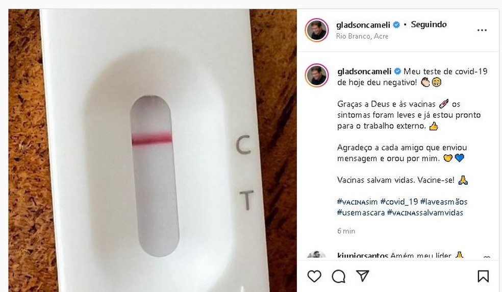 Governador Do Acre Anuncia Que Novo Teste Para Covid Deu Negativo E Se Diz Pronto Para Trabalho Externo Acre G1