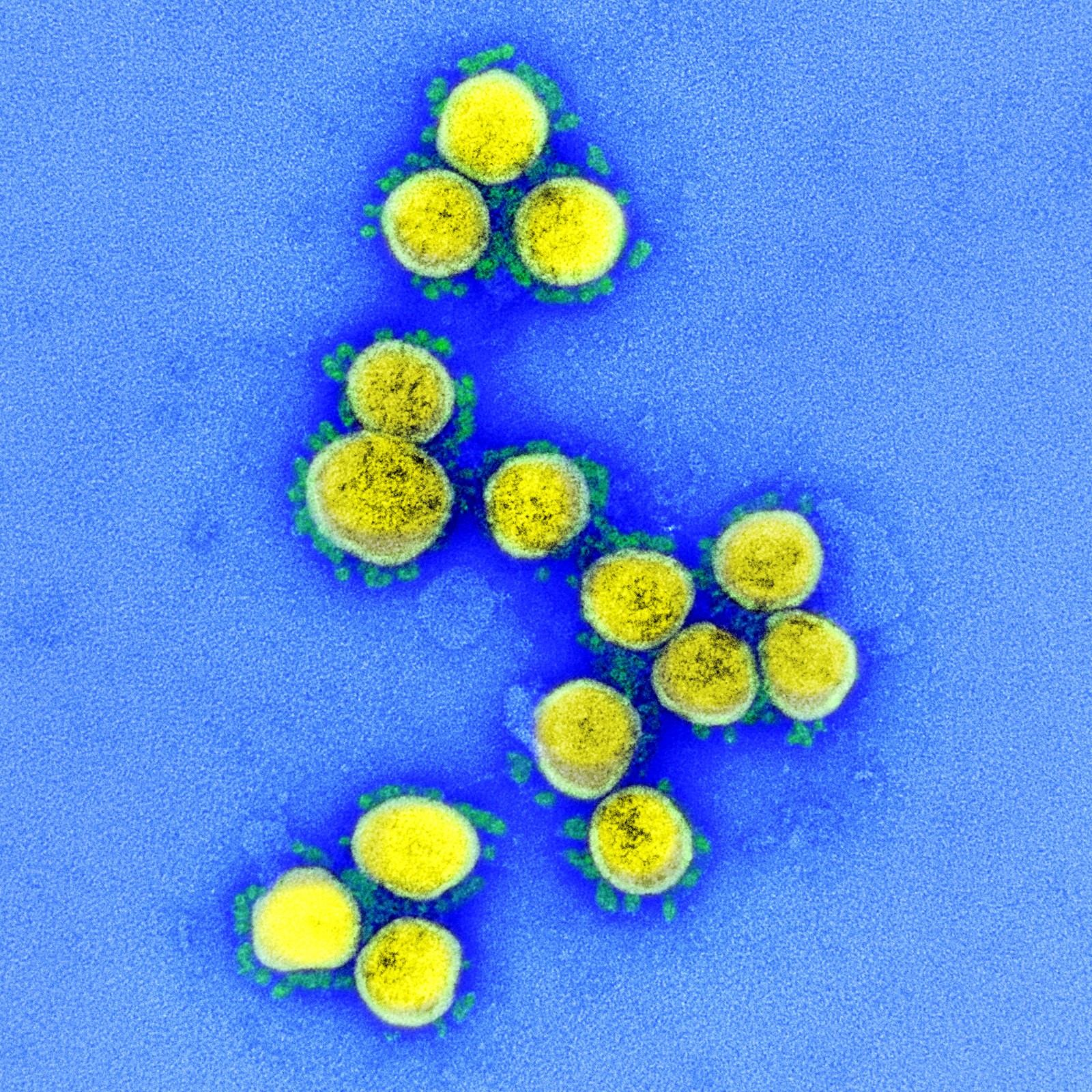 coronavírus covid-19 sars-cov-2 (Foto: NIAID)