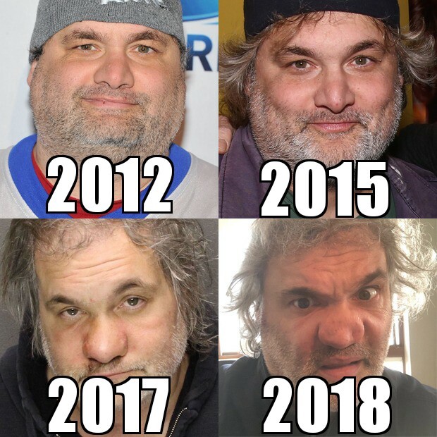 Mudanças no nariz de Artie Lange por conta do abuso de drogas (Foto: Getty Images e Reprodução/Twitter)