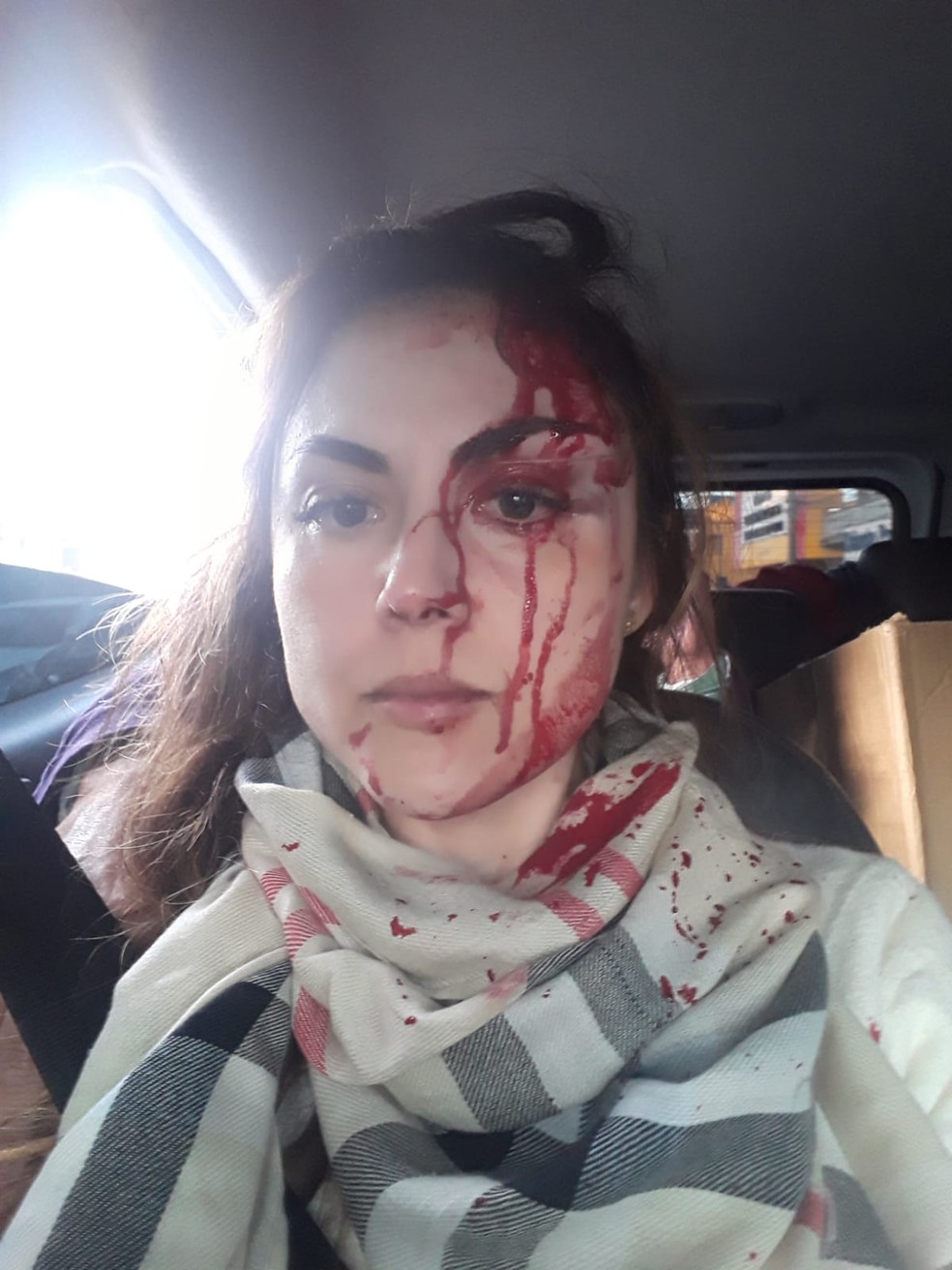 Procuradora foi agredida por diversas vezes no rosto por colega de prefeitura — Foto: Arquivo pessoal