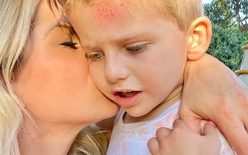 Karina Bacchi mostra filho com machucado na testa: "Já está tudo bem"