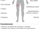 Prefeitura afirma que Manaus tem plano de contingência para ebola