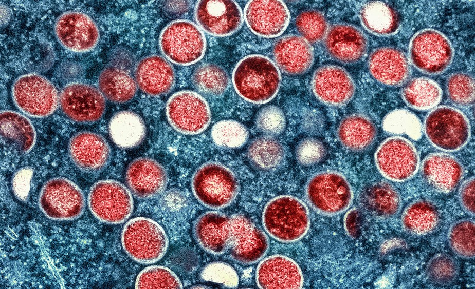 Micrografia eletrônica de transmissão colorida de partículas do vírus da varíola do macaco (vermelho) cultivadas e purificadas a partir de cultura de células
