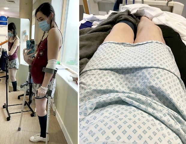Britânica decidiu amputar perna durante gravidez para salvar bebê (Foto: Reprodução/Metro)