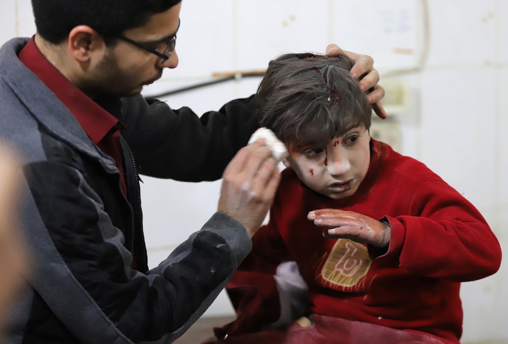 Menino recebe atendimento médico em Kafr Batna, em Guta Oriental, após bombardeio de aviões sírios na região (Foto: Amer Almohibany/AFP)