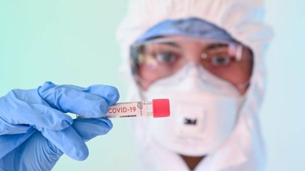 A enzima da bactéria de Yellowstone revolucionou a técnica PCR, usada na atual pandemia do novo coronavírus — Foto: Getty Images via BBC