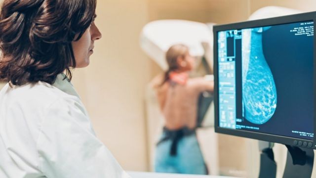O exame de mamografia deve ser realizado anualmente a partir dos 40 anos de idade, se não houver histórico familiar (Foto: GETTY IMAGES (via BBC))