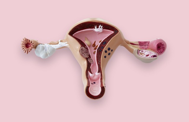 Model of the female reproductive system. (Foto: Getty Images/Science Photo Libra)