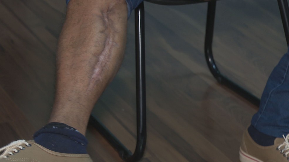 Policial militar aposentado Ronaldo Machado foi atingido por arma na perna, no DF — Foto: TV Globo/Reprodução