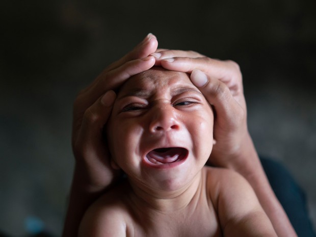 José Wesley, que nasceu com microcefalia e chora incontrolavelmente por longos períodos, é atendido em Bonito, Pernambuco (Foto: Felipe Dana/AP)