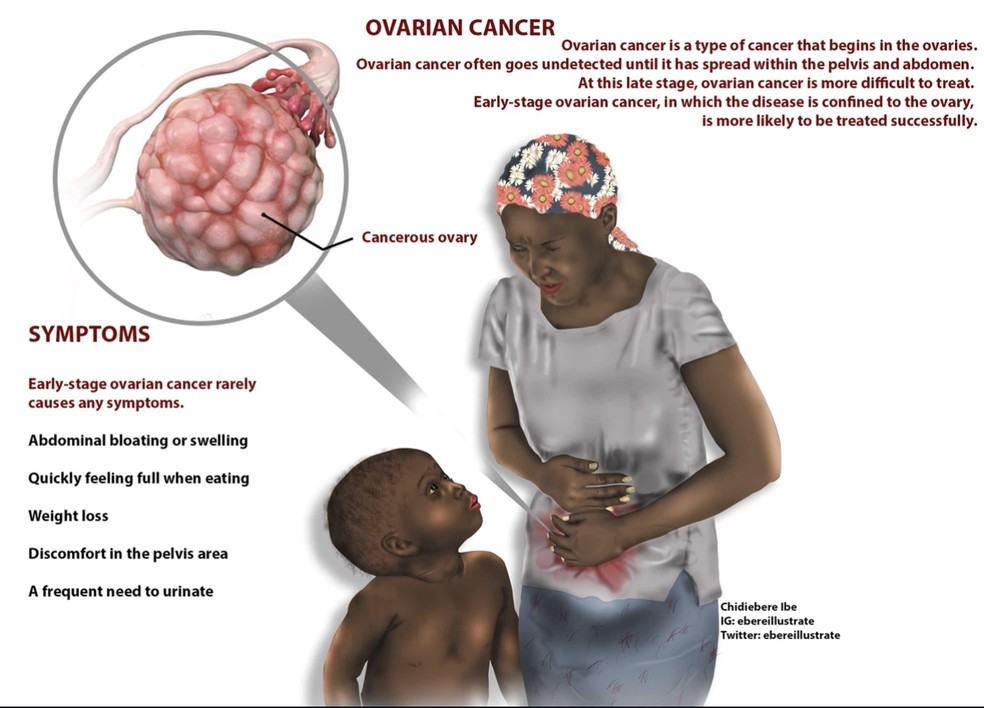 Ilustração médica de Chidiebere Ibe sobre câncer no ovário mostra mãe e filho, ambos de pele negra. — Foto: Reprodução/Chidiebere Ibe
