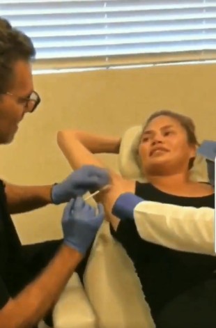 Chrissy Teigen compartilha vídeo de aplicação de botox nas axilas (Foto: Reprodução/Twitter)