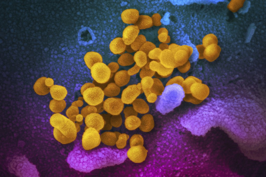 Imagem ilustrativa n&atilde;o-datada mostra o Sars CoV-2, indicado em amarelo, emergindo da superf&iacute;cie de c&eacute;lulas, indicadas em azul/rosa. &mdash; Foto: NIAID-RML/ASSOCIATED PRESS