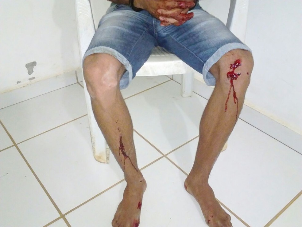 Suspeito foi encaminhado para a Unisp  (Foto: Machadinho190/Reprodução)