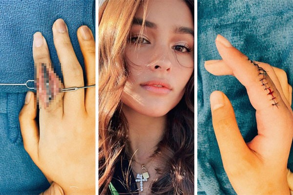Liza soberano e as imagens de sua operação no dedo indicador (Foto: reprodução instagram)