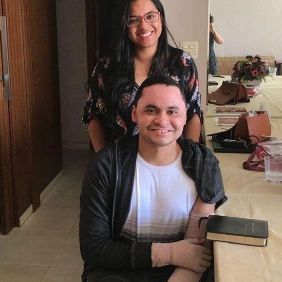Daniel com sua amiga Andréa, com curativos nos braços após sair do hospital; eles hoje ajudam maranhenses vítimas de queimaduras (Foto: Arquivo pessoal via BBC Brasil)