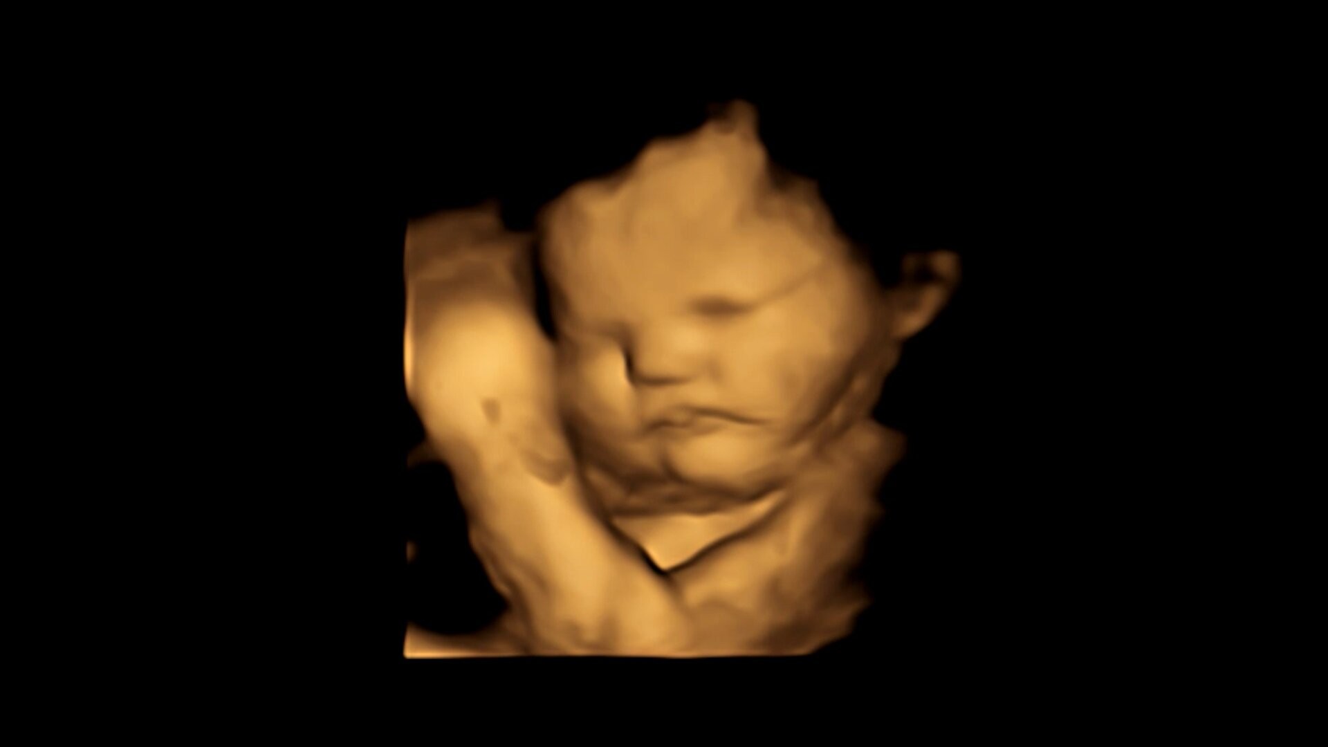 Uma imagem de varredura 4D de um feto  (Foto: Estudo FETAP (Fetal Taste Preferences)/Laboratório de Pesquisa Fetal e Neonatal/Universidade de Durham)