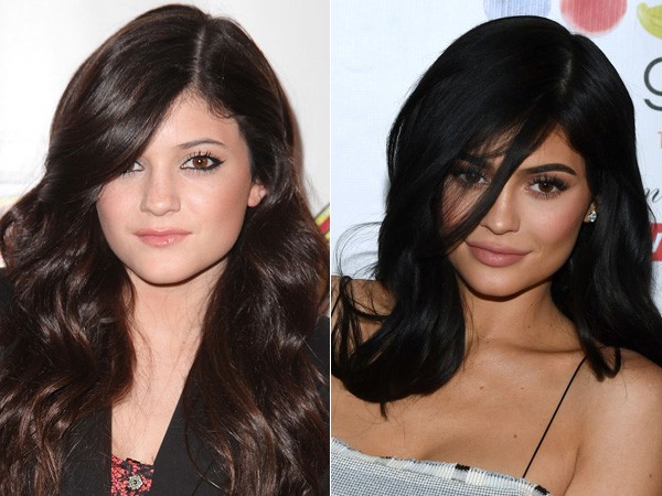 Kylie Jenner – 2010 | 2017 (Foto:  Getty Images)