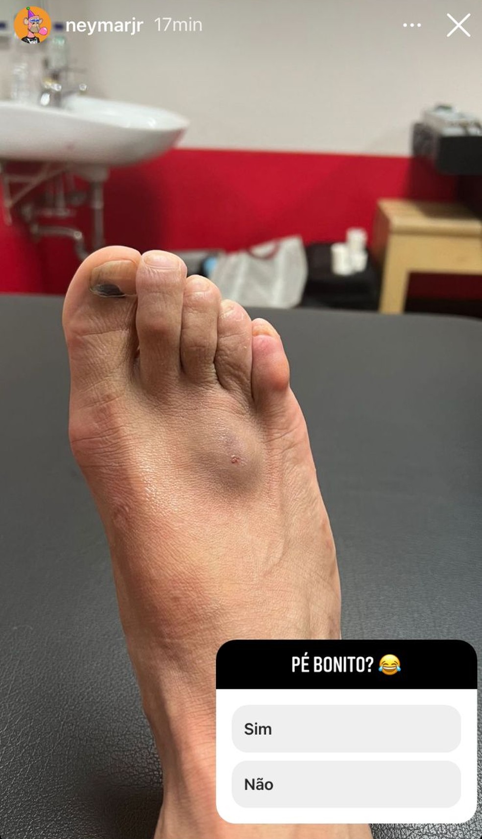 Neymar publicou foto do pé machucado em rede social — Foto: Reprodução / Instagram