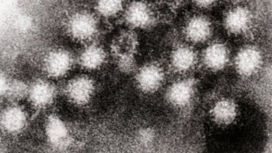 Norovírus: entenda como ocorre a infecção que causa diarreia em SC