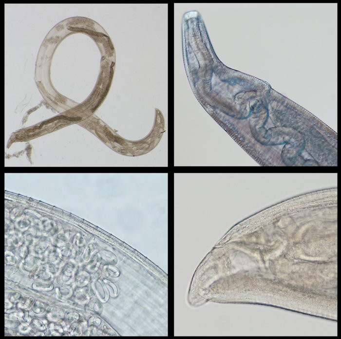 Verme fêmea da espécie T. gulosa; Verme com ovos (canto inferior esquerdo) (Foto: Bradbury et al., Clinical Infectious Diseases, 2019)